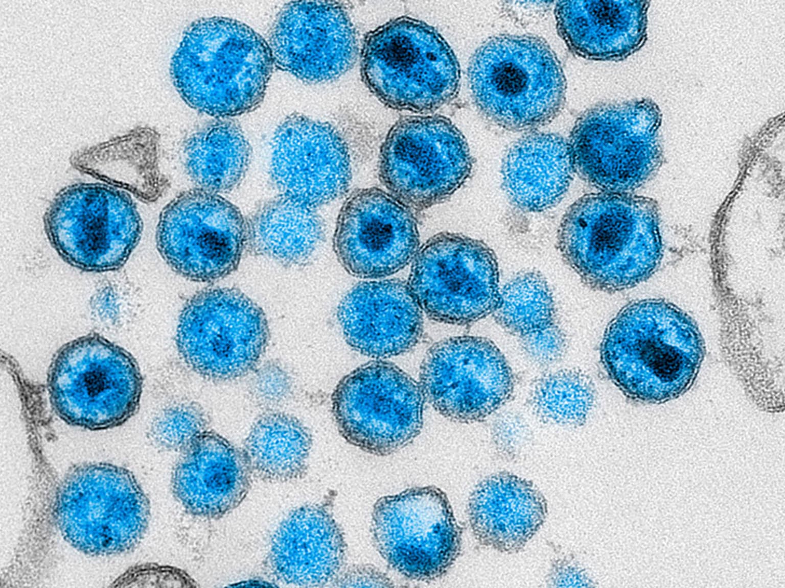 Jenseits des Buyers Club