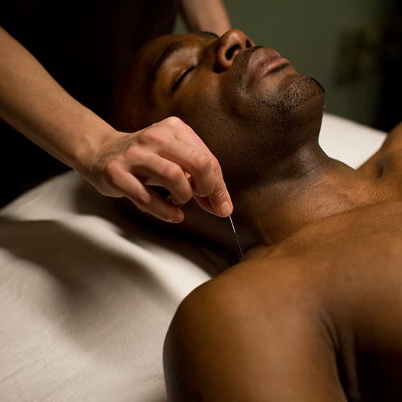 Ich habe Akupunktur gegen Stress und Gelenkschmerzen ausprobiert